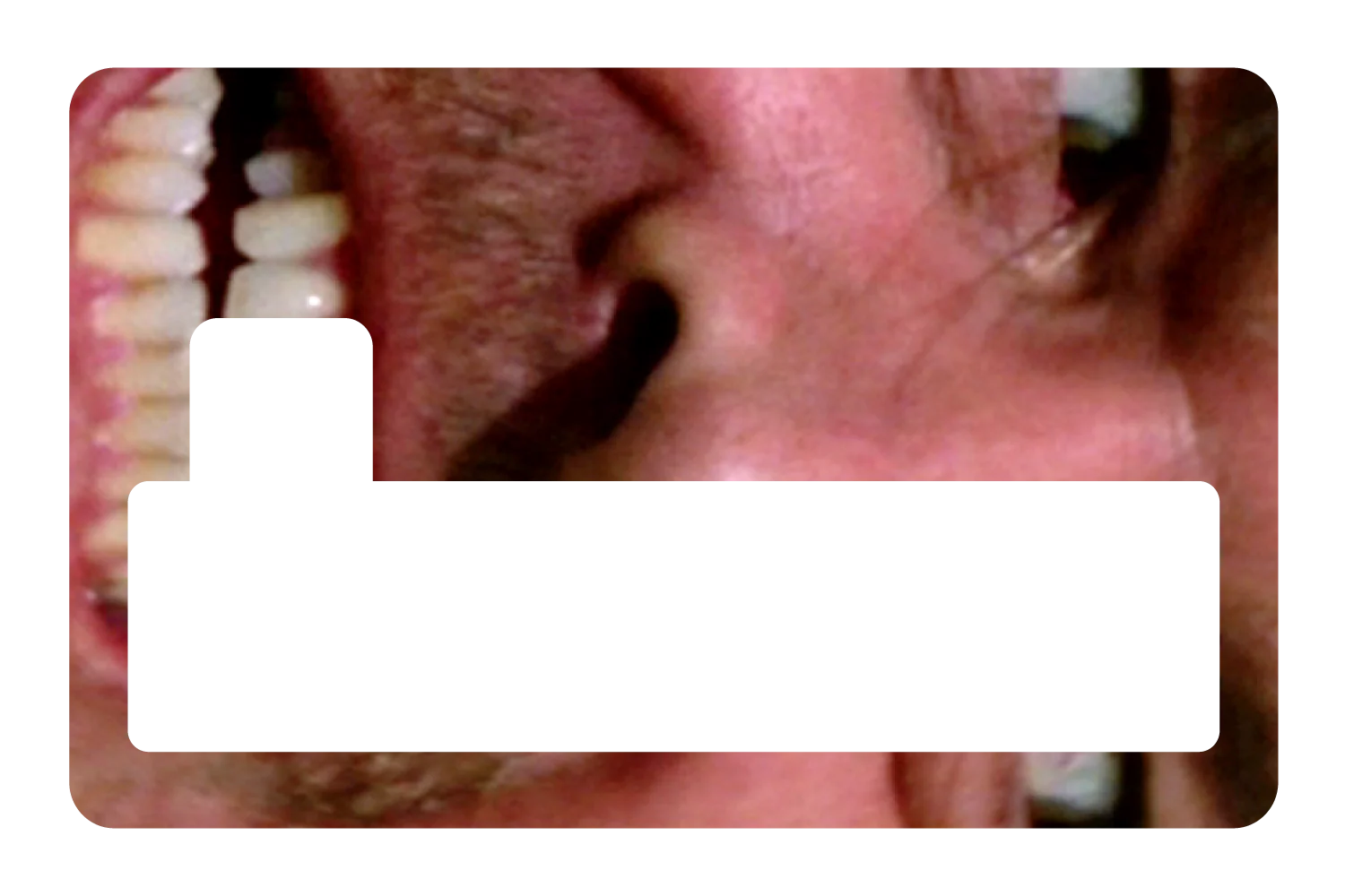 Shining - Image 4