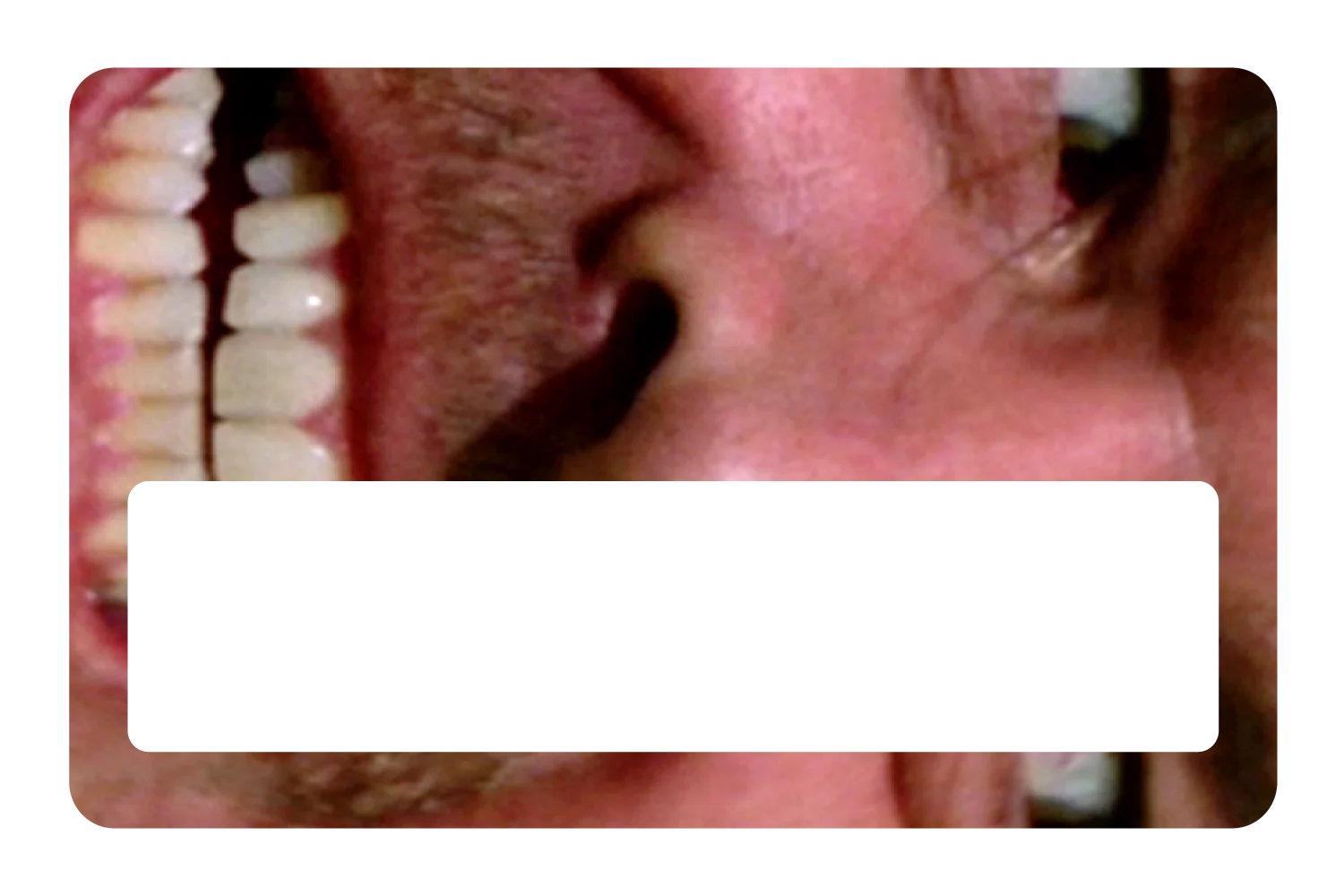 Shining - Image 6