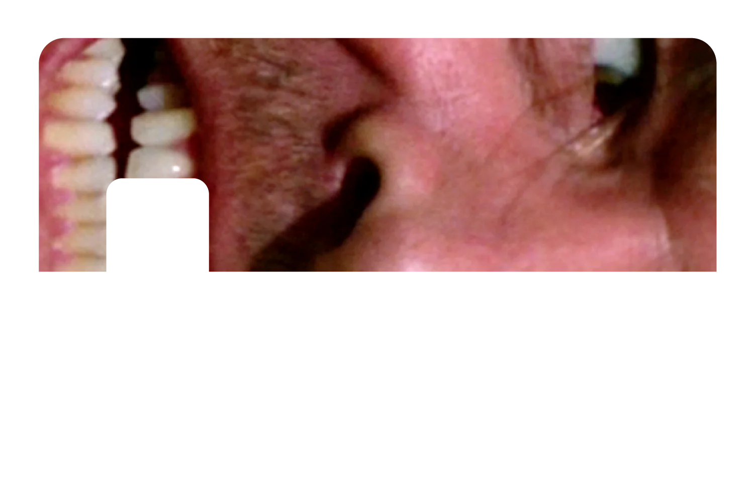 Shining - Image 7