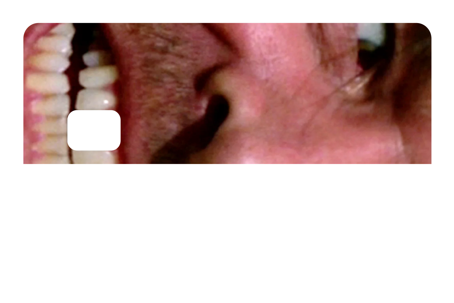 Shining - Image 8