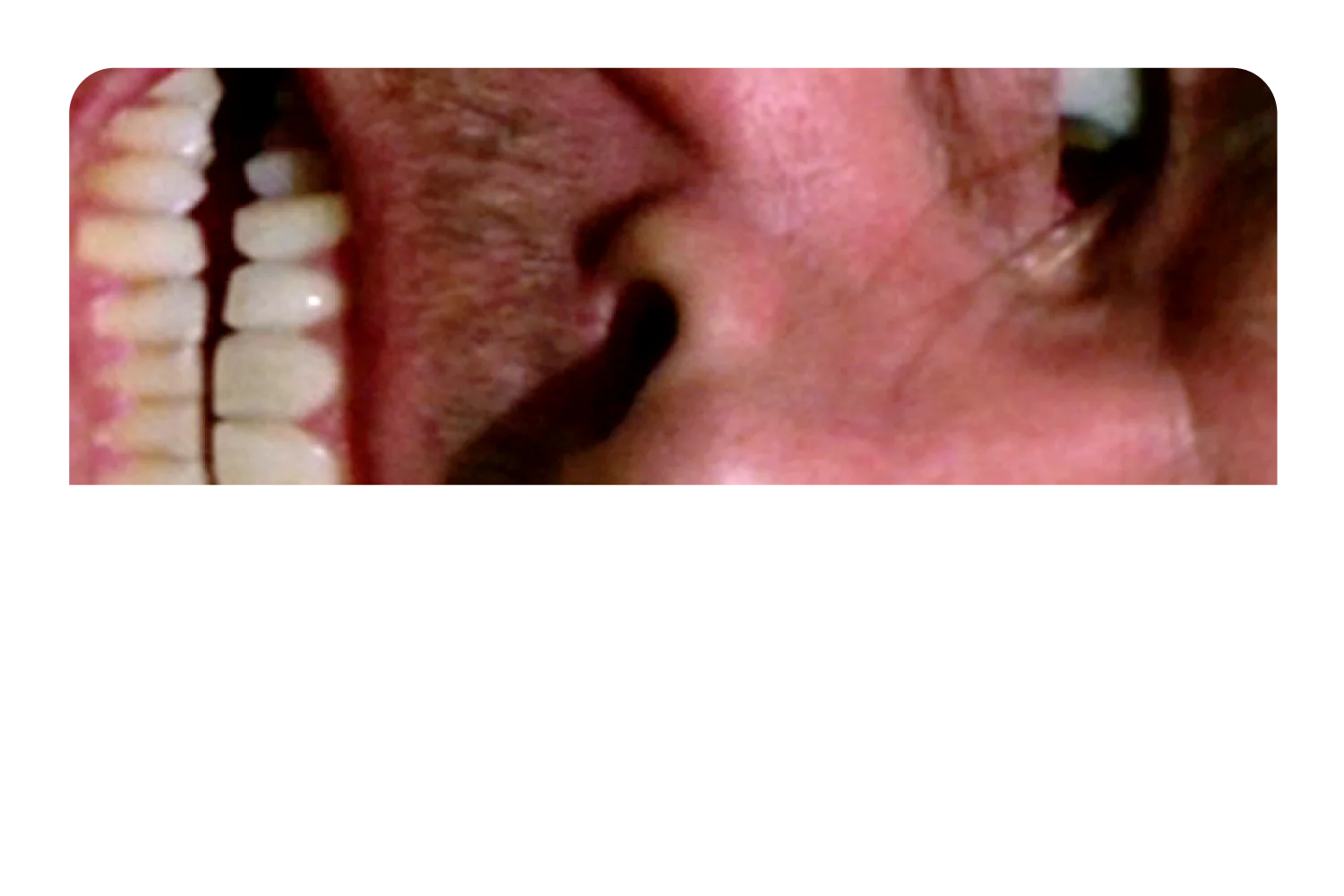 Shining - Image 9