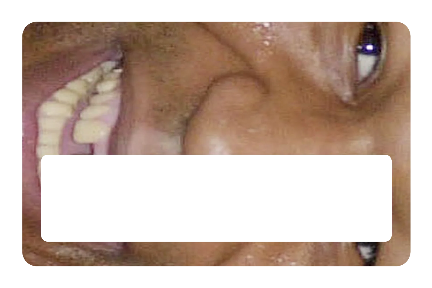 Tyson Grillz - Image 6